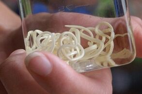 паразиты из организма человека